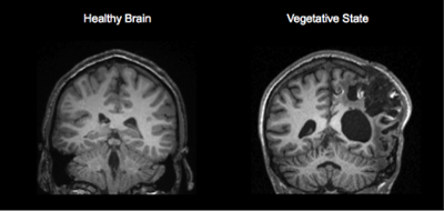 mri